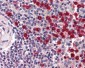 MMP9 / Gelatinase B Antibody